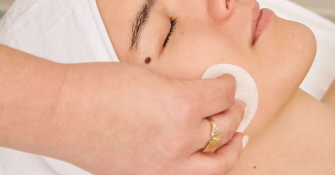 After the Glow: How to Care for Your Skin After a Facial or Chemical Peel image