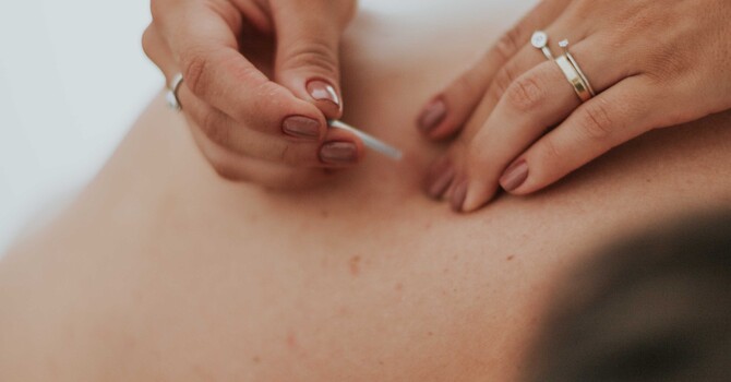 Acupuncture and Gentle Electrical Stimulation