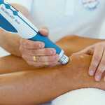 radial shockwave therapy