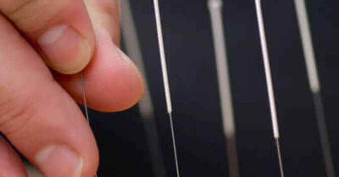 Acupuncture