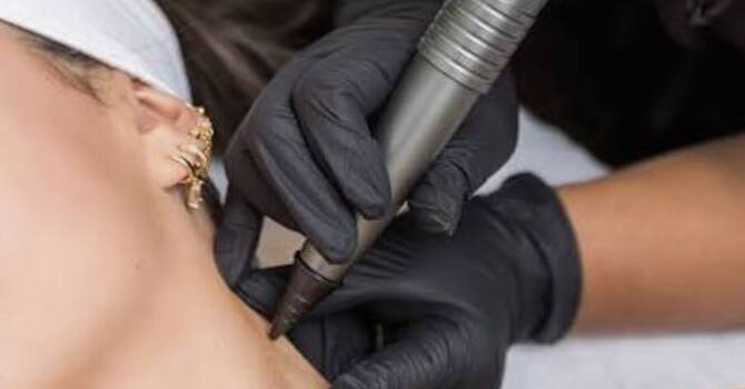 FreezPen Benign Skin Lesion Removal