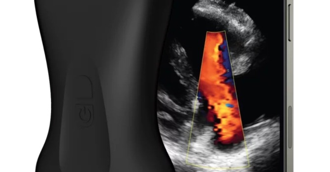 Ultrasound Mapping Treatments