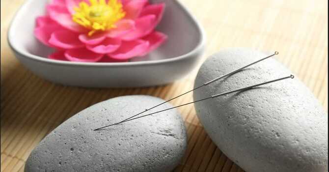 ACUPUNCTURE