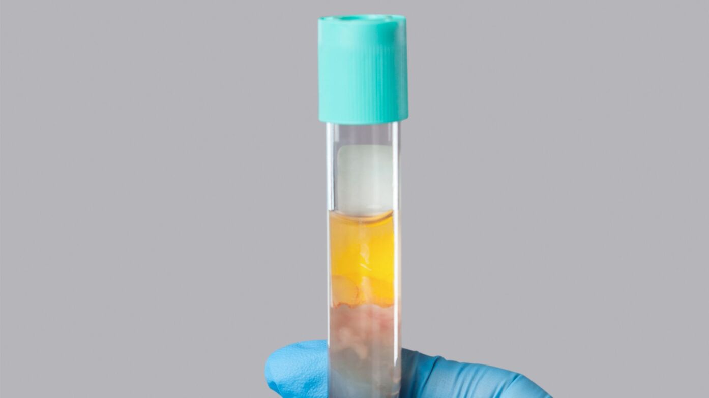 PRP