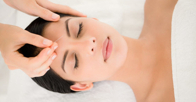Acupuncture