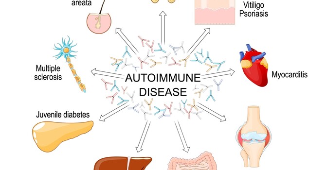 Understanding Autoimmune Conditions image