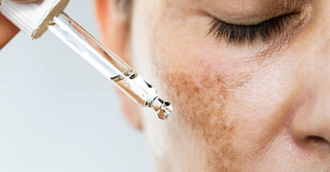 Glutathione IV Skin Lightening image