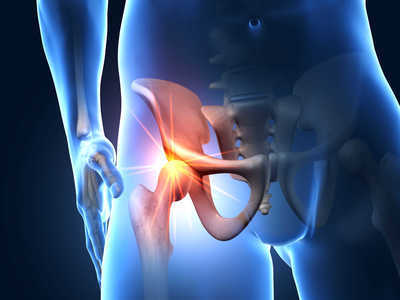 femoral acetabular impingement