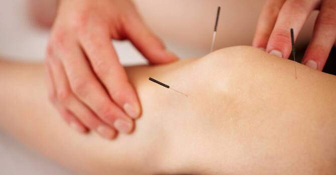 COMMUNITY ACUPUNCTURE image