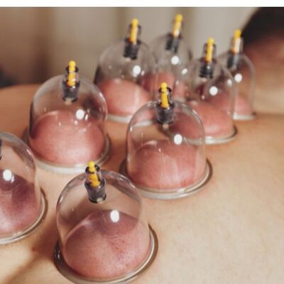 Cupping Therapy