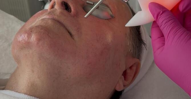 Anti-Aging & Skin Rejuvenation (Laser & HIFU)