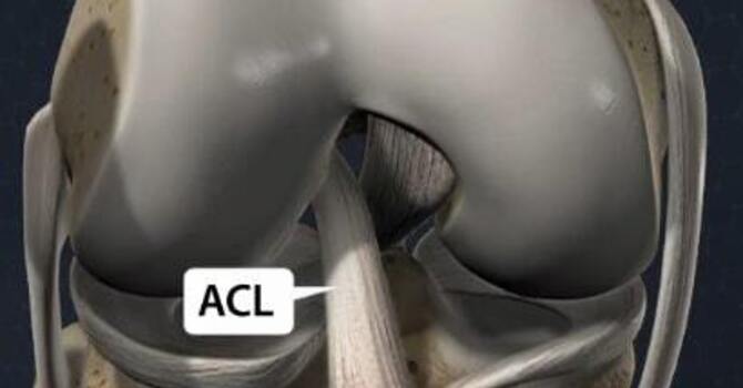 ACL Rehabilitation in Amersham, Buckinghamshire image