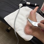 Using Graston or FAKTR tools to scrape fascial adhesions