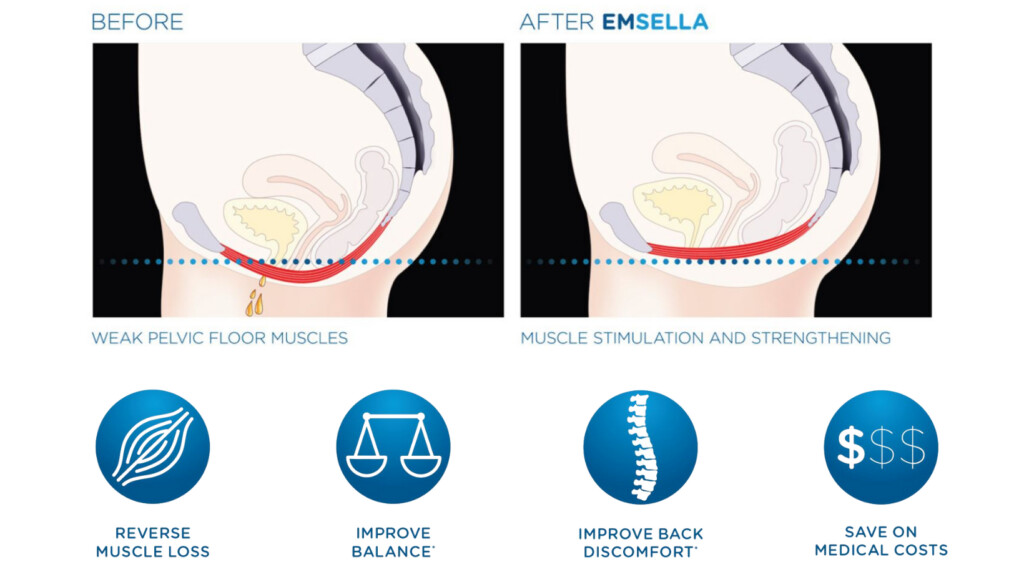 Emsella-Chair-Technology-Page-1024x577