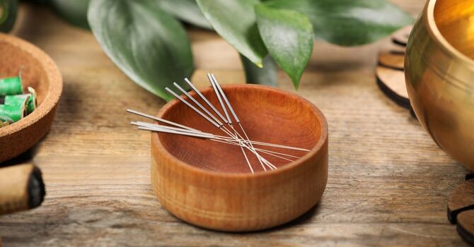 Acupuncture for Stress and Anxiety: How It Works and When It Helps Most
