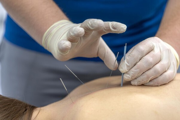 acupuncture clinic Tottenham Ontario