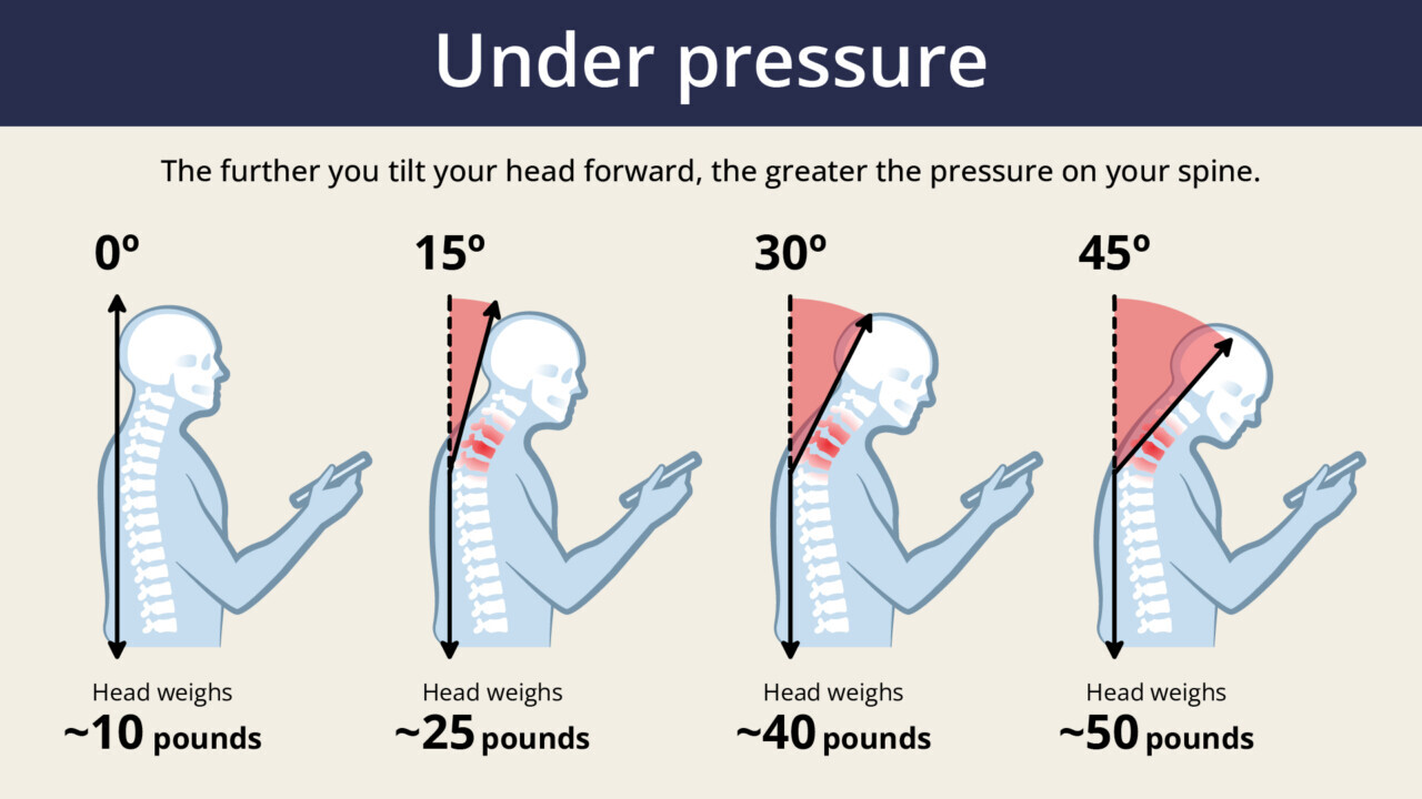 Illustration of tech neck posture issues affecting Waukee residents at desks
