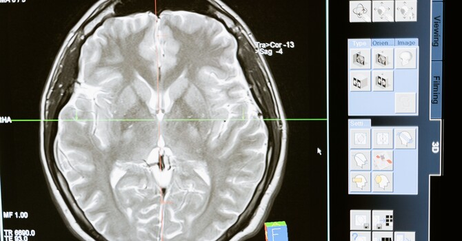 MRI Findings Don’t Always Equal Pain
