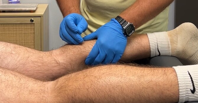 Is Dry Needling Enough By Itself? Do I Also Need Rehabilitation?